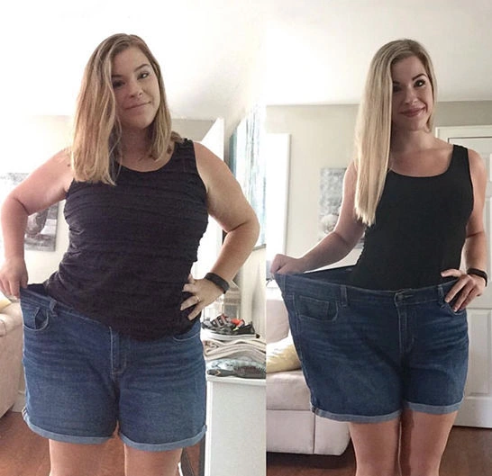A second stock before-and-after photograph supplied in the seller&rsquo;s marketing kit