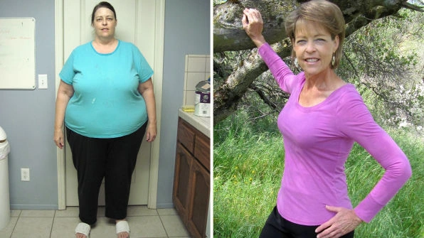 A third stock before-and-after photograph supplied in the seller&rsquo;s marketing kit